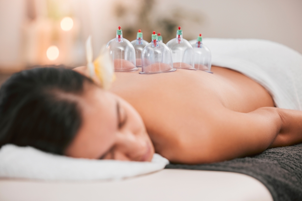 Naturopathic cupping treatment in north vancouver
